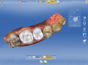 Biokiefer_Biojaw