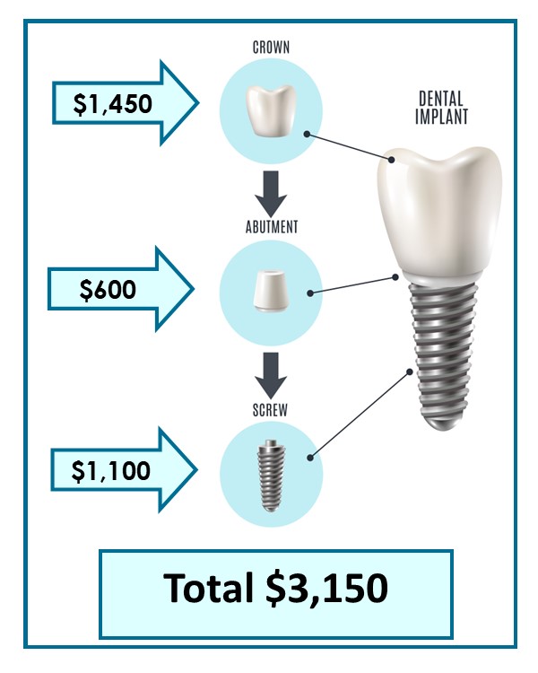 Cost Of Implant 