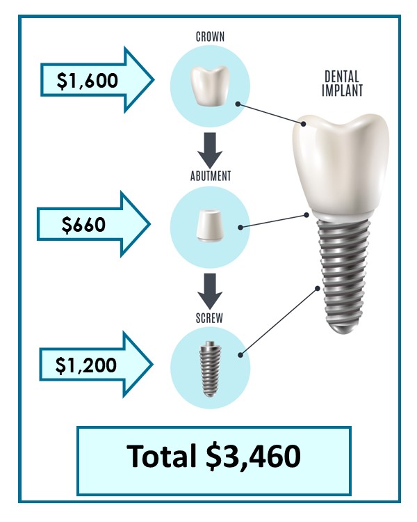 Dental Implant Faqs In Cincinnati, Oh 