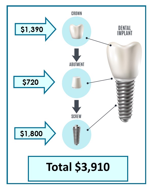 2026 cost of implant