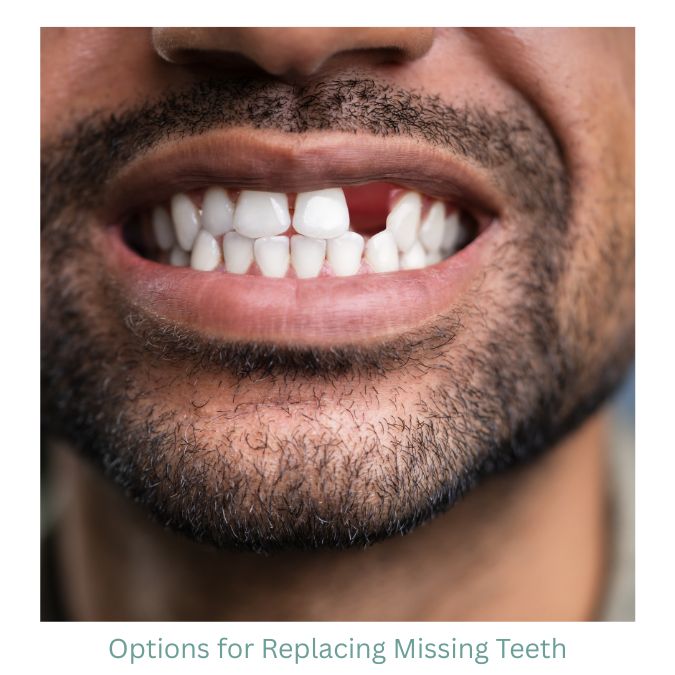 A man smiling to reveal a missing tooth