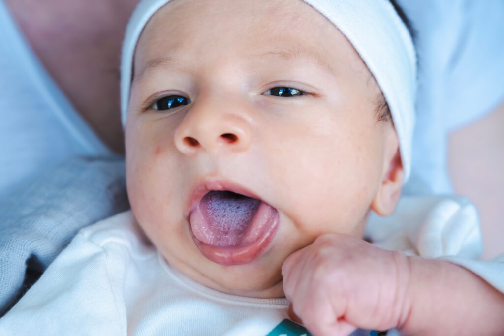 Photo of a newborn baby with thrush on their tongue.